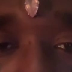 Lil Uzi Vert Explains His Massive Forehead Diamond