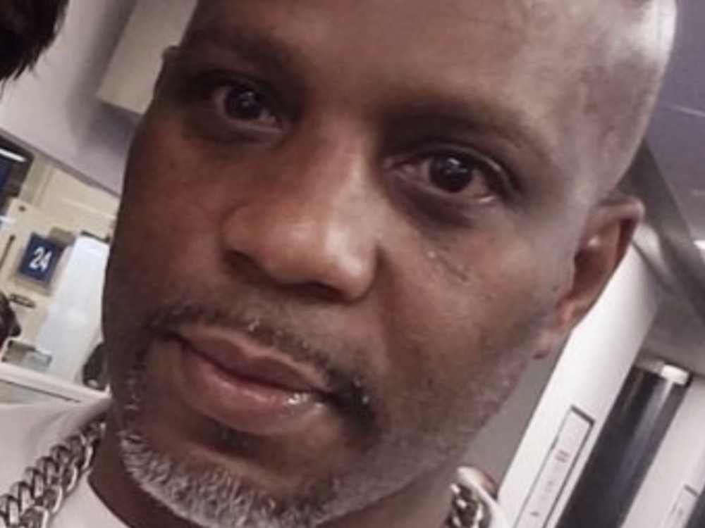 DMX’s Family Might Have To Make Hard Decisions Following Brain Tests
