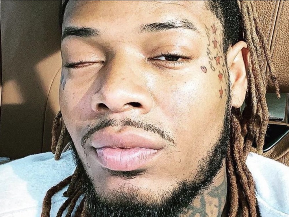 Fetty Wap’s Daughter Death Cause Revealed